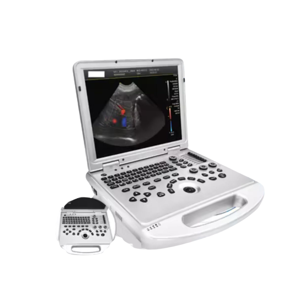 Doppler a color, 2D